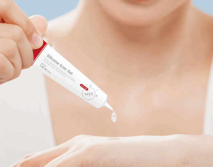 Silicone Scar Dressing Tubular - Image 4