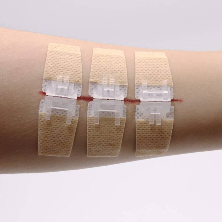 Wound Closures Device - Image 4