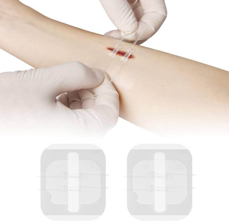 Wound Closures Device - Image 5