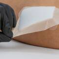 How to Choose a Silicone Foam Dressing Supplier.